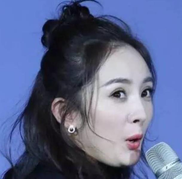 削骨多久能恢复(面部截骨多久时间可以恢复)(23)