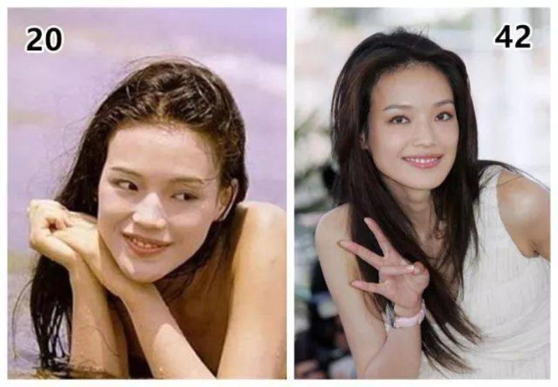 削骨多久能恢复(面部截骨多久时间可以恢复)(55)